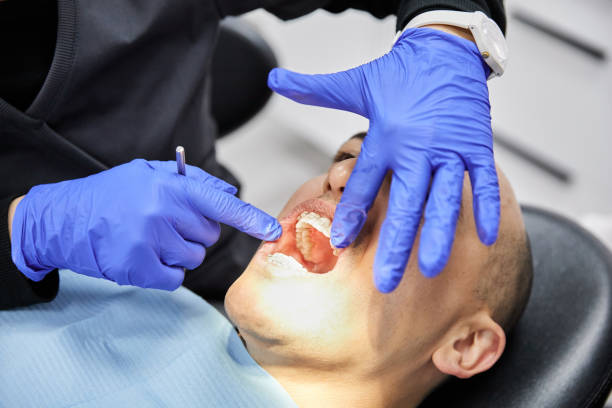 Best Emergency Dental Extractions in Seagraves, TX