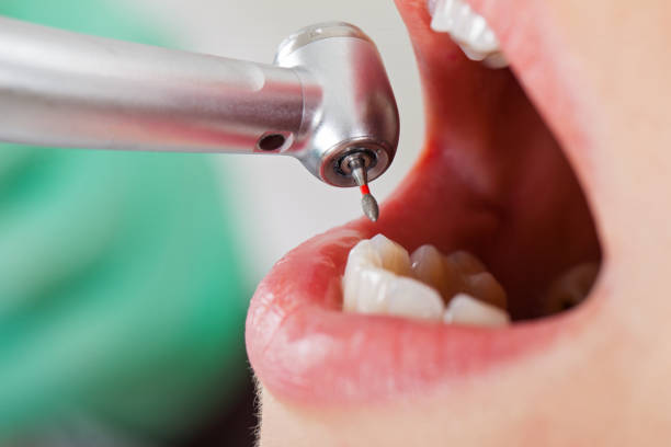 Best Urgent Dental Care for Toothache in Seagraves, TX
